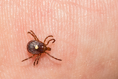 tick walking on human hand